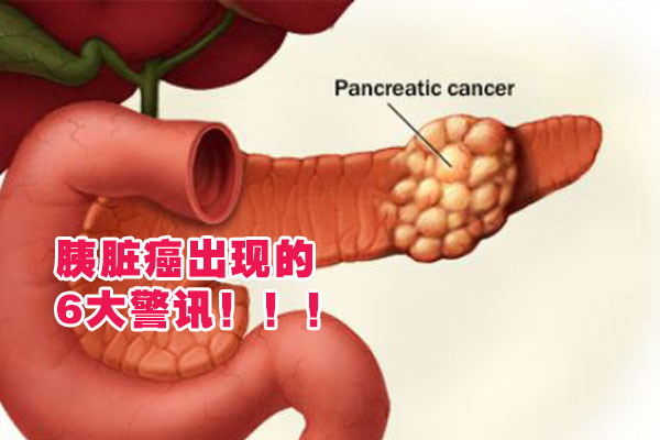 blog_photo_a3